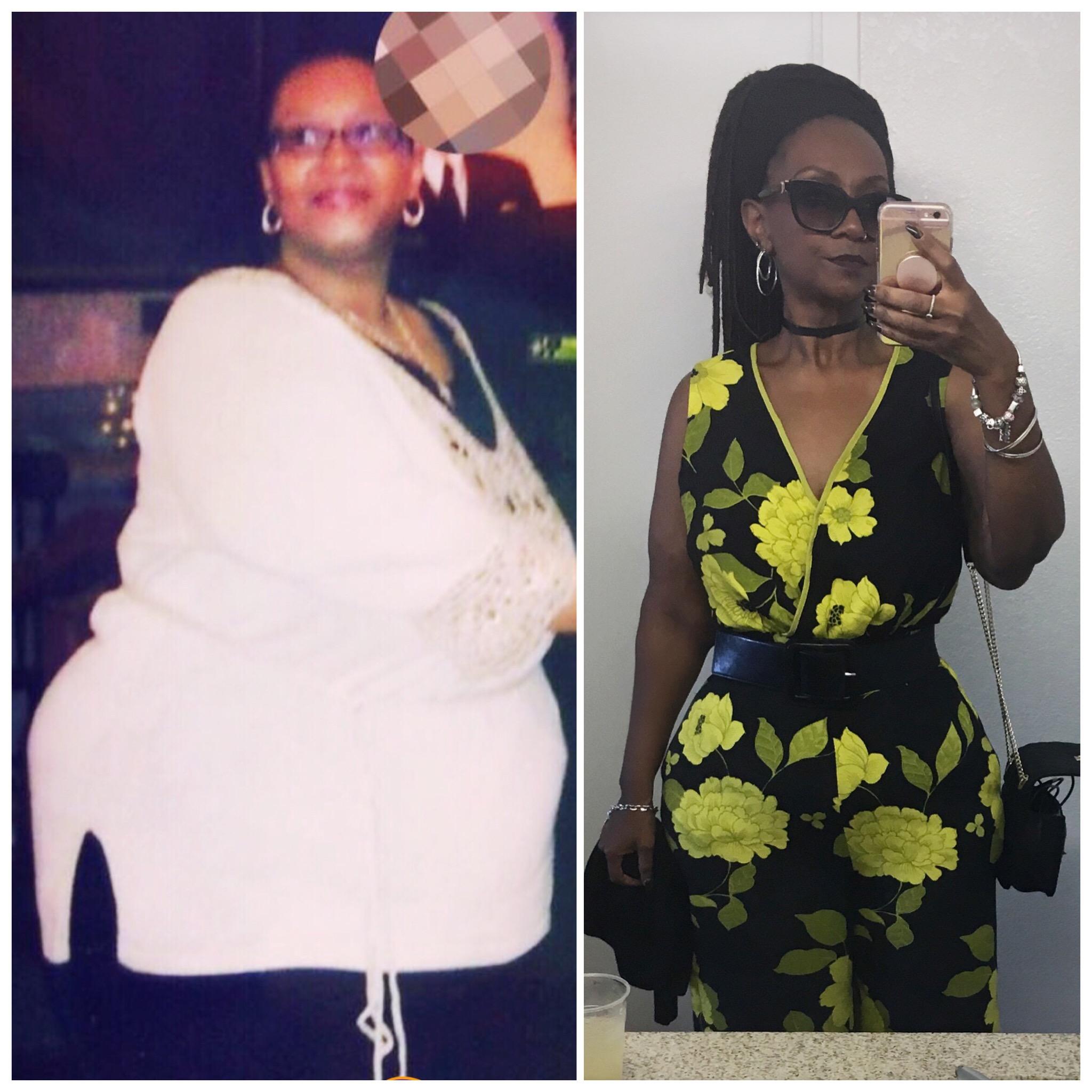 Before and After 148 lbs Fat Loss 5 feet 6 Female 326 lbs to 178 lbs