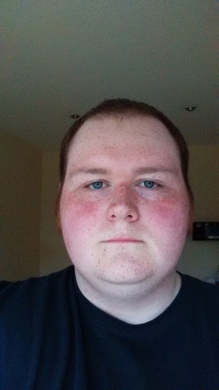 Progress Pics of 82 lbs Fat Loss 6 foot Male 389 lbs to 307 lbs
