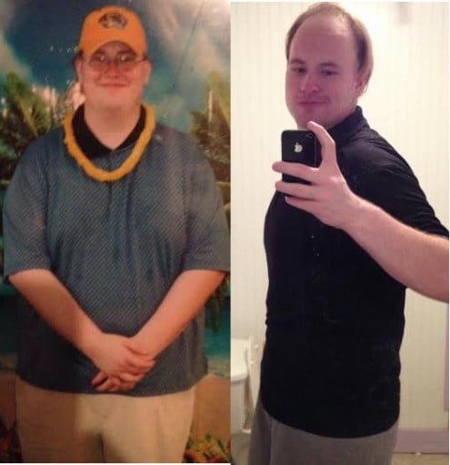 A before and after photo of a 6'6" male showing a weight reduction from 497 pounds to 247 pounds. A net loss of 250 pounds.