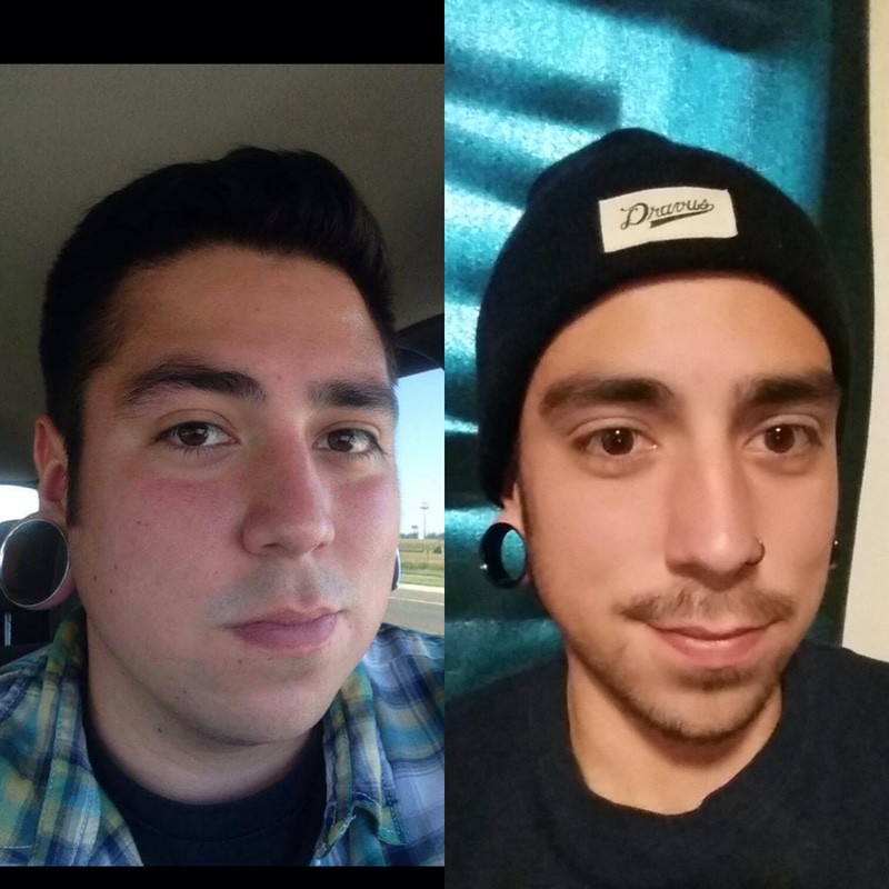 5 feet 11 Male Before and After 90 lbs Fat Loss 260 lbs to 170 lbs