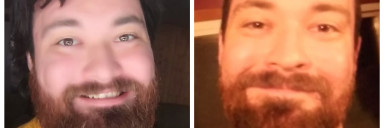 Progress Pics of 100 lbs Weight Loss 5'8 Male 300 lbs to 200 lbs
