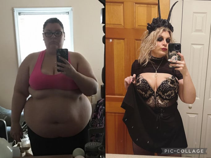 A before and after photo of a 5'5" female showing a weight reduction from 384 pounds to 201 pounds. A net loss of 183 pounds.