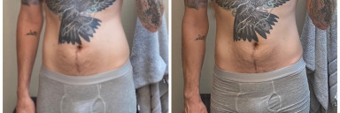 6'3 Male 10 lbs Muscle Gain Before and After 170 lbs to 180 lbs