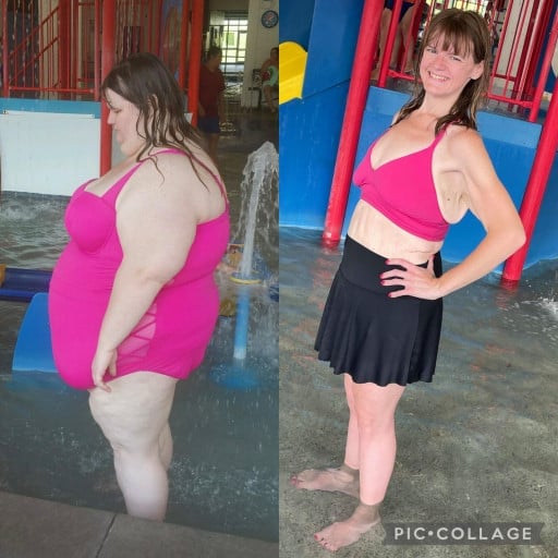 A picture of a 5'6" female showing a weight loss from 425 pounds to 150 pounds. A respectable loss of 275 pounds.