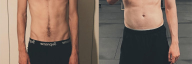 6'5 Male 43 lbs Weight Gain Before and After 154 lbs to 197 lbs
