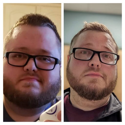 6 foot Male Before and After 170 lbs Fat Loss 415 lbs to 245 lbs