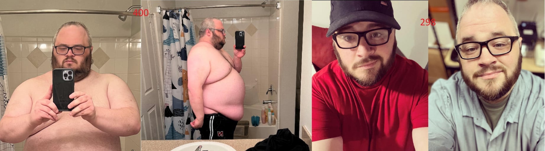 A before and after photo of a 5'11" male showing a weight reduction from 400 pounds to 298 pounds. A net loss of 102 pounds.