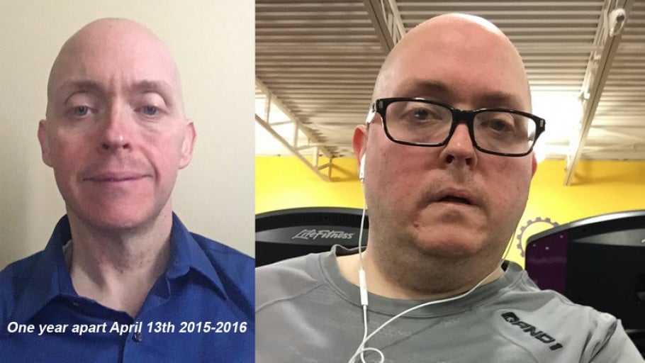 138 lbs Weight Loss Before and After 5 feet 6 Male 289 lbs to 151 lbs