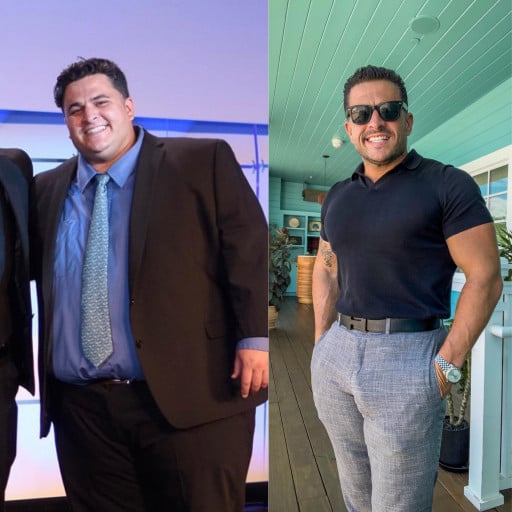 203 lbs Fat Loss Before and After 5 foot 9 Male 410 lbs to 207 lbs