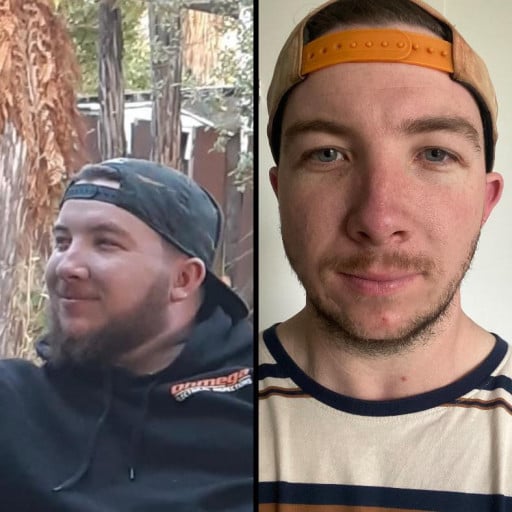 Before and After 70 lbs Weight Loss 5 feet 6 Male 250 lbs to 180 lbs