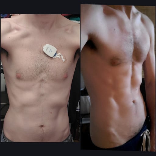 Progress Pics of 14 lbs Muscle Gain 6 foot Male 120 lbs to 134 lbs