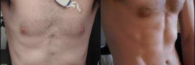 Progress Pics of 14 lbs Muscle Gain 6 foot Male 120 lbs to 134 lbs