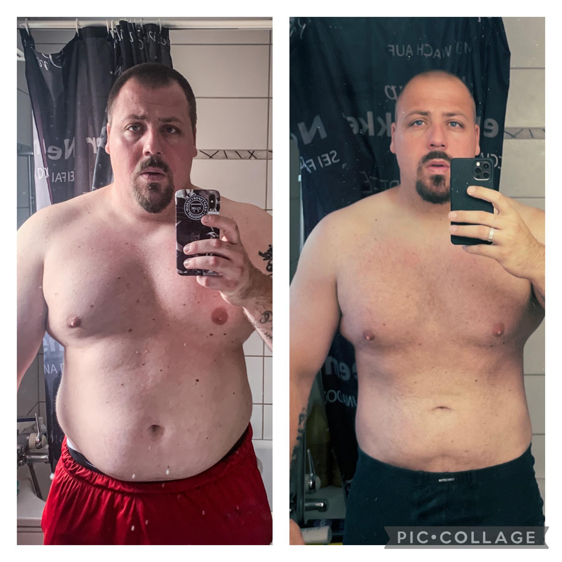 6 feet 1 Male Before and After 70 lbs Weight Loss 332 lbs to 262 lbs