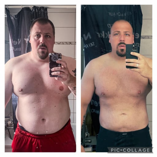 A before and after photo of a 6'1" male showing a weight reduction from 332 pounds to 262 pounds. A net loss of 70 pounds.
