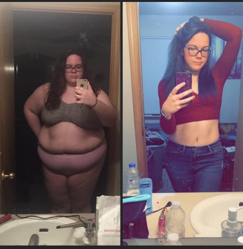 A picture of a 5'9" female showing a weight loss from 370 pounds to 170 pounds. A respectable loss of 200 pounds.