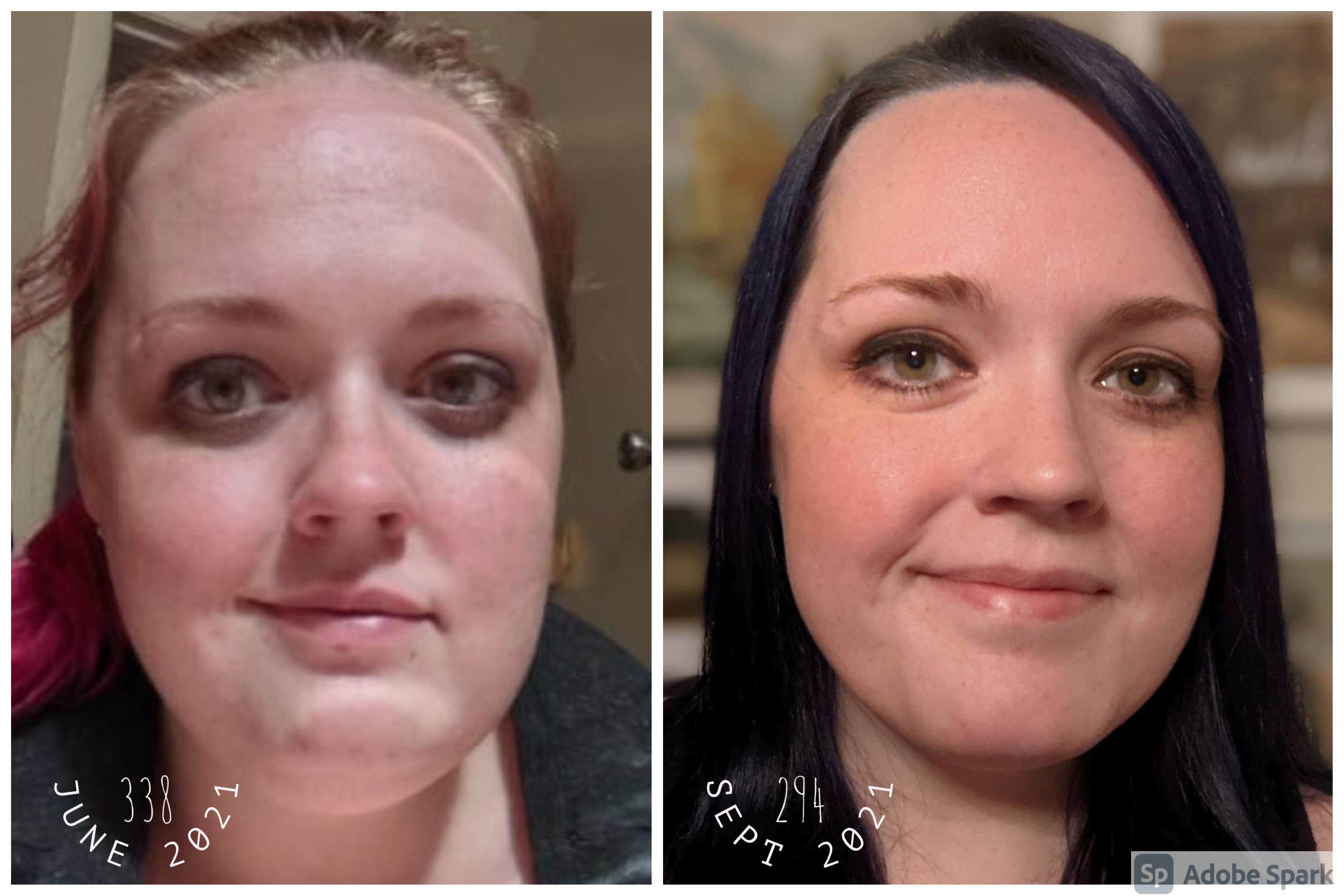 5'7 Female 42 lbs Fat Loss Before and After 336 lbs to 294 lbs