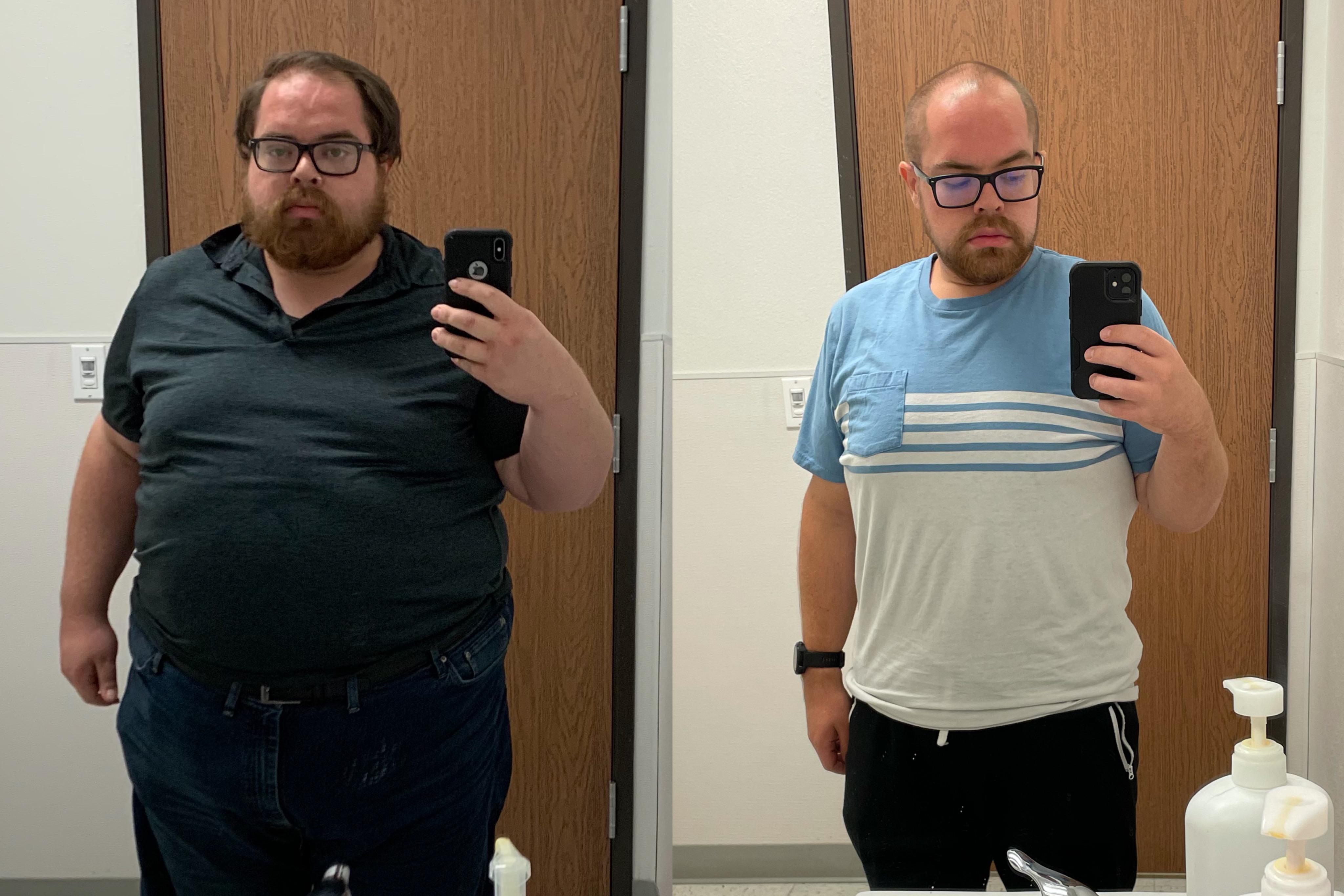 145 lbs Weight Loss Before and After 5'9 Male 368 lbs to 223 lbs