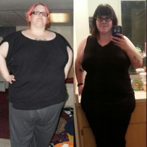A picture of a 5'7" female showing a fat loss from 396 pounds to 259 pounds. A net loss of 137 pounds.