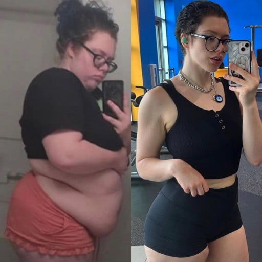 A before and after photo of a 5'8" female showing a weight reduction from 305 pounds to 150 pounds. A net loss of 155 pounds.