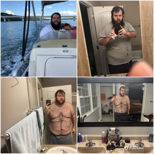 A before and after photo of a 6'4" male showing a weight reduction from 420 pounds to 309 pounds. A net loss of 111 pounds.