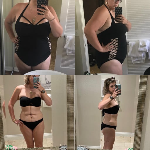 A progress pic of a 6'1" woman showing a fat loss from 311 pounds to 187 pounds. A total loss of 124 pounds.
