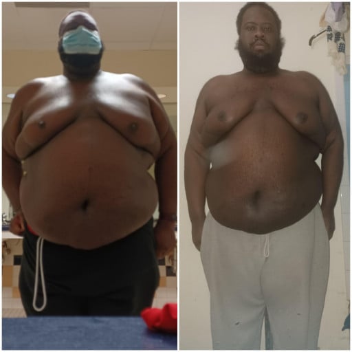 A before and after photo of a 6'0" male showing a weight reduction from 425 pounds to 377 pounds. A net loss of 48 pounds.