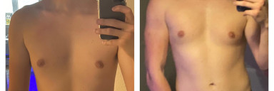 6 foot 2 Male 35 lbs Weight Gain Before and After 145 lbs to 180 lbs