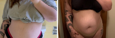 25 lbs Fat Loss Before and After 5 feet 3 Female 250 lbs to 225 lbs