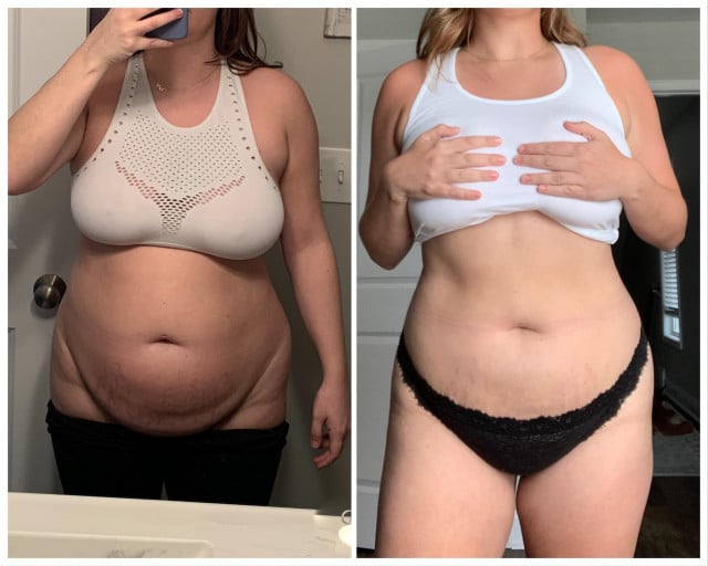 Woman's 32Lbs Weight Loss Journey a Reddit Story