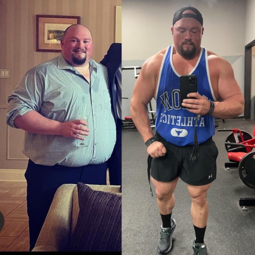 A before and after photo of a 5'10" male showing a weight reduction from 410 pounds to 265 pounds. A net loss of 145 pounds.