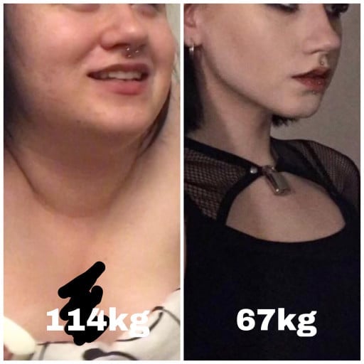 A photo of a 5'10" woman showing a weight cut from 251 pounds to 147 pounds. A total loss of 104 pounds.