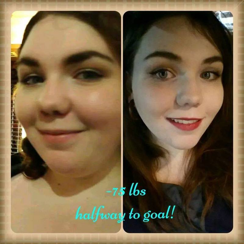 75 lbs Fat Loss Before and After 5 foot 5 Female 315 lbs to 240 lbs