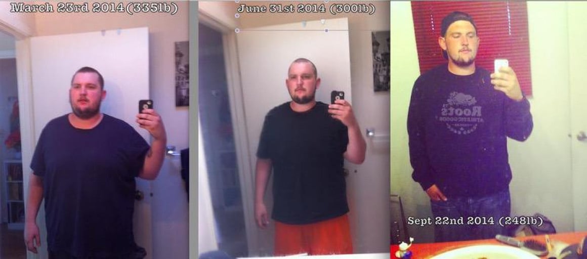 A before and after photo of a 5'11" male showing a weight reduction from 350 pounds to 248 pounds. A total loss of 102 pounds.