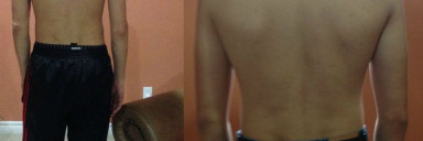 35 lbs Weight Gain 5 foot 11 Male 125 lbs to 160 lbs