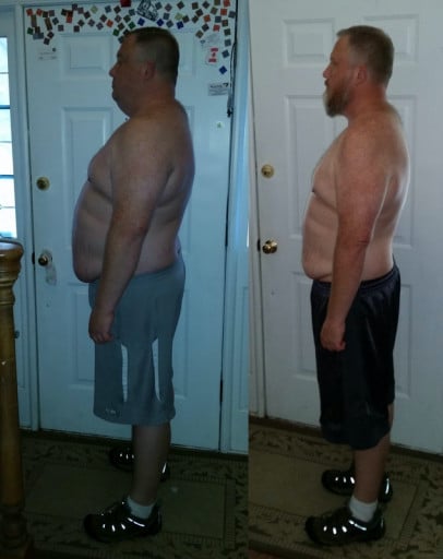A photo of a 6'1" man showing a weight reduction from 340 pounds to 260 pounds. A total loss of 80 pounds.
