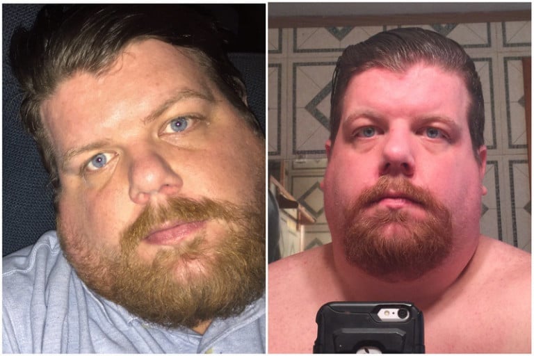 46 lbs Fat Loss Before and After 6 foot 1 Male 443 lbs to 397 lbs