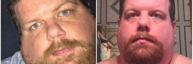 46 lbs Fat Loss Before and After 6 foot 1 Male 443 lbs to 397 lbs
