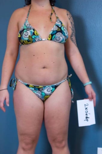 A before and after photo of a 5'0" female showing a snapshot of 160 pounds at a height of 5'0