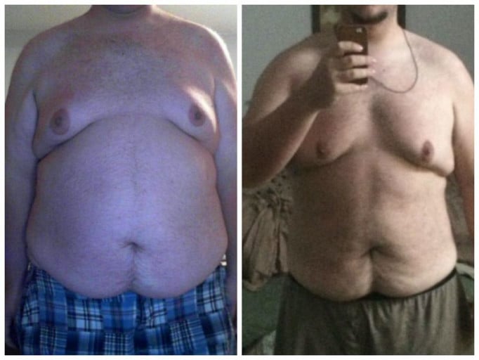 A before and after photo of a 6'4" male showing a weight reduction from 410 pounds to 335 pounds. A total loss of 75 pounds.