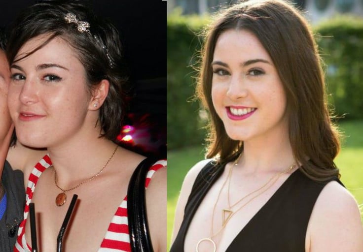 User's Journey: Losing 21 Lbs Resulting in a Noticeable Face Progress