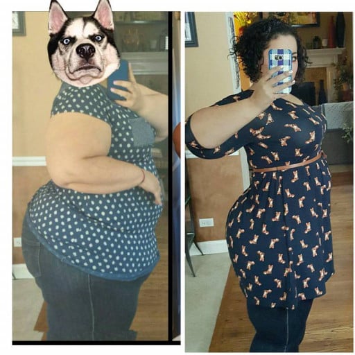 5 feet 8 Female Before and After 156 lbs Weight Loss 469 lbs to 313 lbs