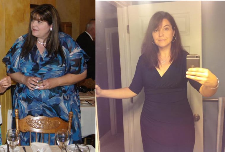 A progress pic of a 5'10" woman showing a fat loss from 320 pounds to 170 pounds. A net loss of 150 pounds.