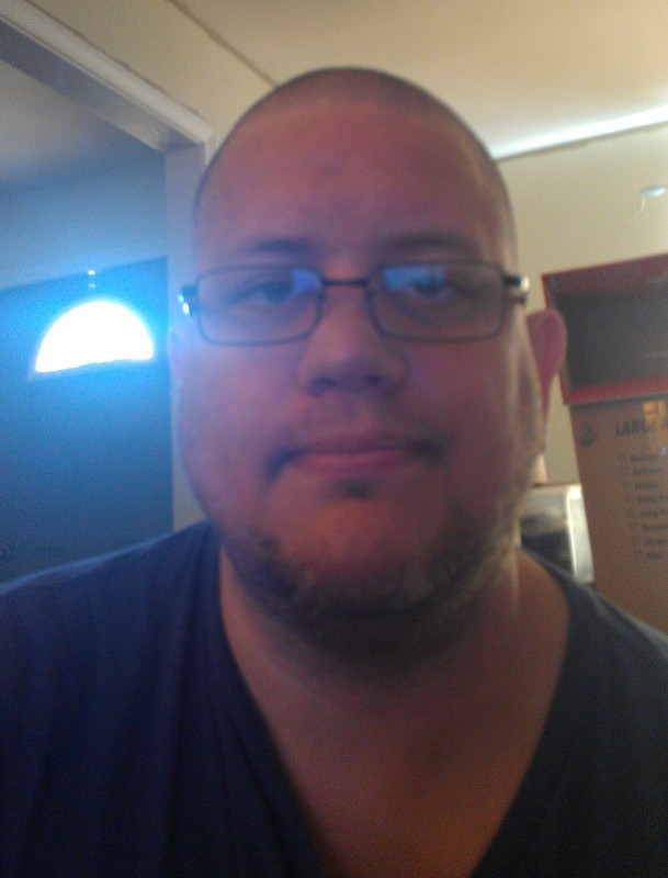 6 foot 5 Male 161 lbs Weight Loss Before and After 402 lbs to 241 lbs