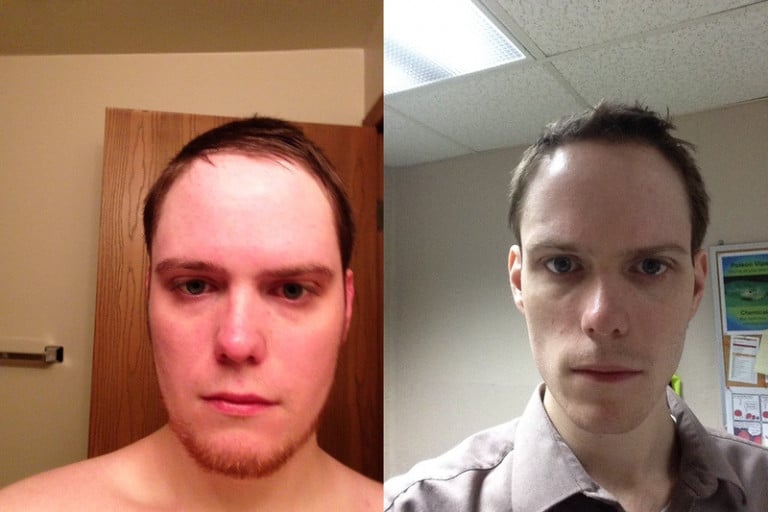 Male Loses 100 Pounds in 1 Year 3 Months, See the Crazy Difference It Makes to His Face