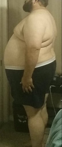 A before and after photo of a 6'3" male showing a snapshot of 493 pounds at a height of 6'3