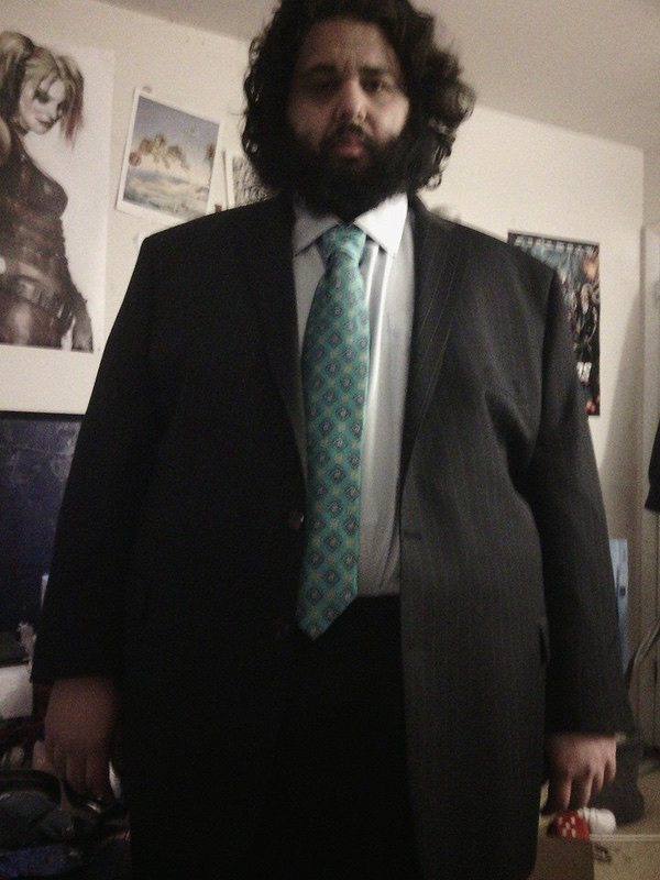 130 lbs Weight Loss Before and After 6 foot Male 375 lbs to 245 lbs