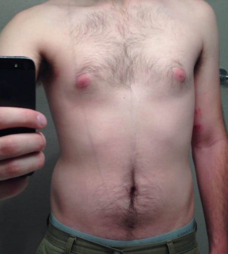 17 Year Old Male's Incredible Transformation From 195Lbs to Shredded!