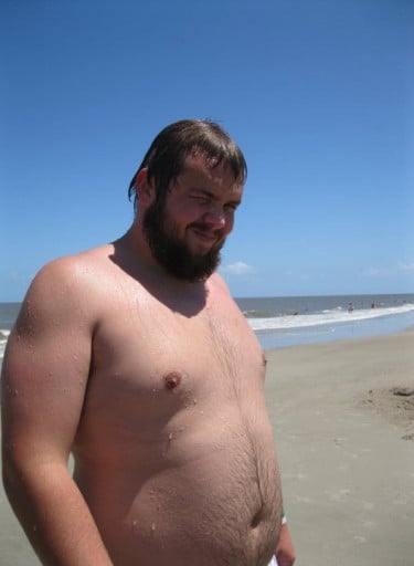 A before and after photo of a 6'5" male showing a fat loss from 308 pounds to 208 pounds. A total loss of 100 pounds.