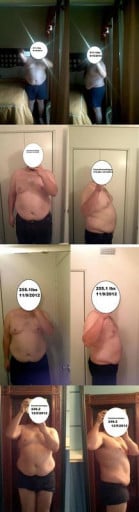 A before and after photo of a 5'10" male showing a weight reduction from 311 pounds to 249 pounds. A net loss of 62 pounds.