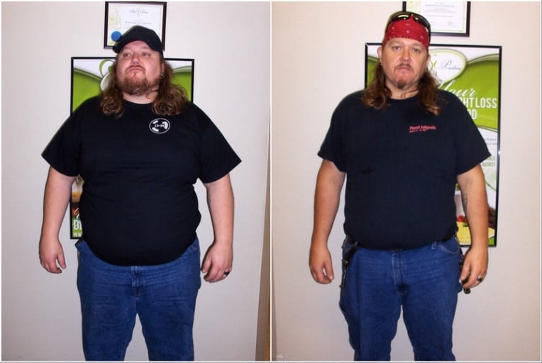 A photo of a 5'11" man showing a weight cut from 362 pounds to 261 pounds. A net loss of 101 pounds.